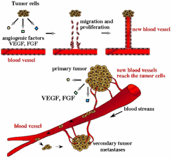 tumor angiogenesis-1.jpg