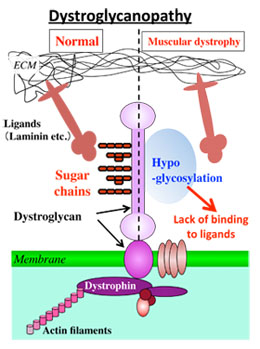 Dystroglycanopathy